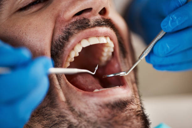 Best Dental Fillings (Composite and Amalgam)  in Waverly, IL